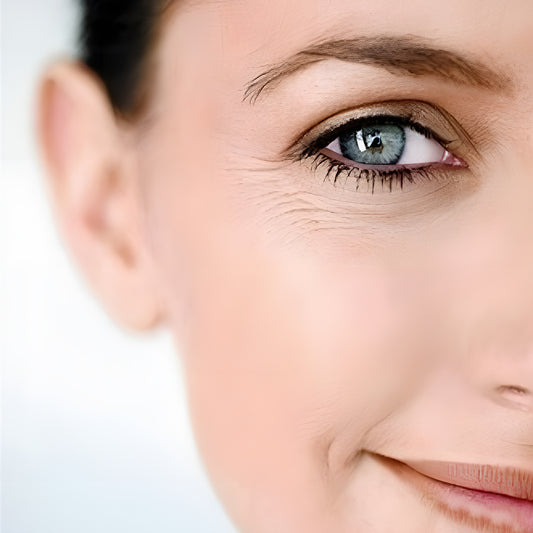 Removing Crow's Feet: Causes, Treatment, and Care Guide